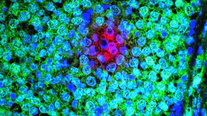 LOS EJERCICIOS MENTALES QUE PODRIAN SER LA CURA DEL CANCER