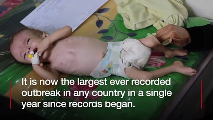 Yemen's cholera epidemic 'largest ever recorded' - BBC News