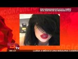 Kim Kardashian explica el cambio en el rostro de su hermana Kylie / Joanna Vegabiestro