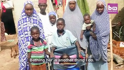 The 19 year Girl Who Lives In A Bowl