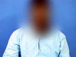 Treatment for baldness in India