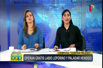 Caritas Felices: niños con labio leporino pueden operarse de forma gratuita