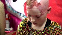 11 Year Old Girl Scalped From Carnival Ride Gets Wig For First Day of School