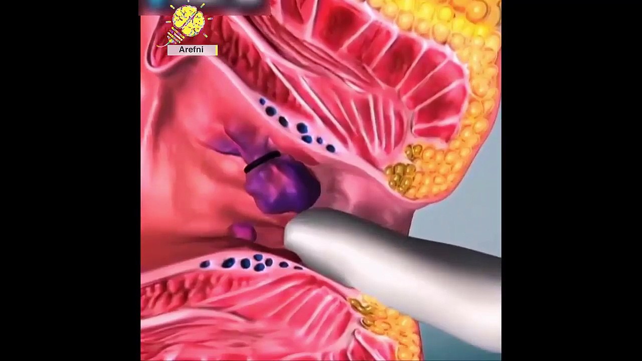 Watch How A Doctors Perform Surgery ★ Hair Transplant | Hemorrhoid | Teeth Implants