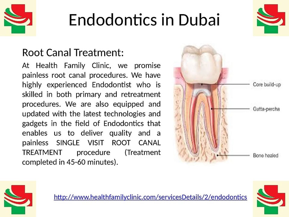 Best Quality Painless Endodontics Root Canal Treatment in Dubai United Arab Emirates (UAE)