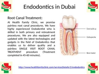 Best Quality Painless Endodontics Root Canal Treatment in Dubai United Arab Emirates (UAE)