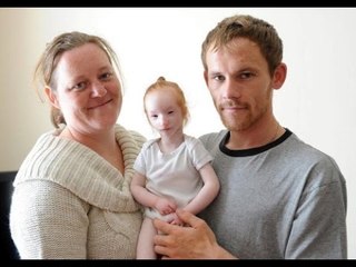 Charlotte Garside- The Smallest Girl in the World