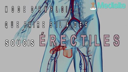 Mode d'emploi : que faire s'il a des soucis érectiles ?