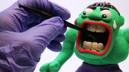 Hulk VAMPIRE TOILET ATTACK! Frozen Elsa Play Doh Superheroes in Real Life Stop Motion