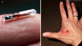 Microchip Implant in Humans | The Future of Identity | RFID Chip Implants | Future Technology Explained