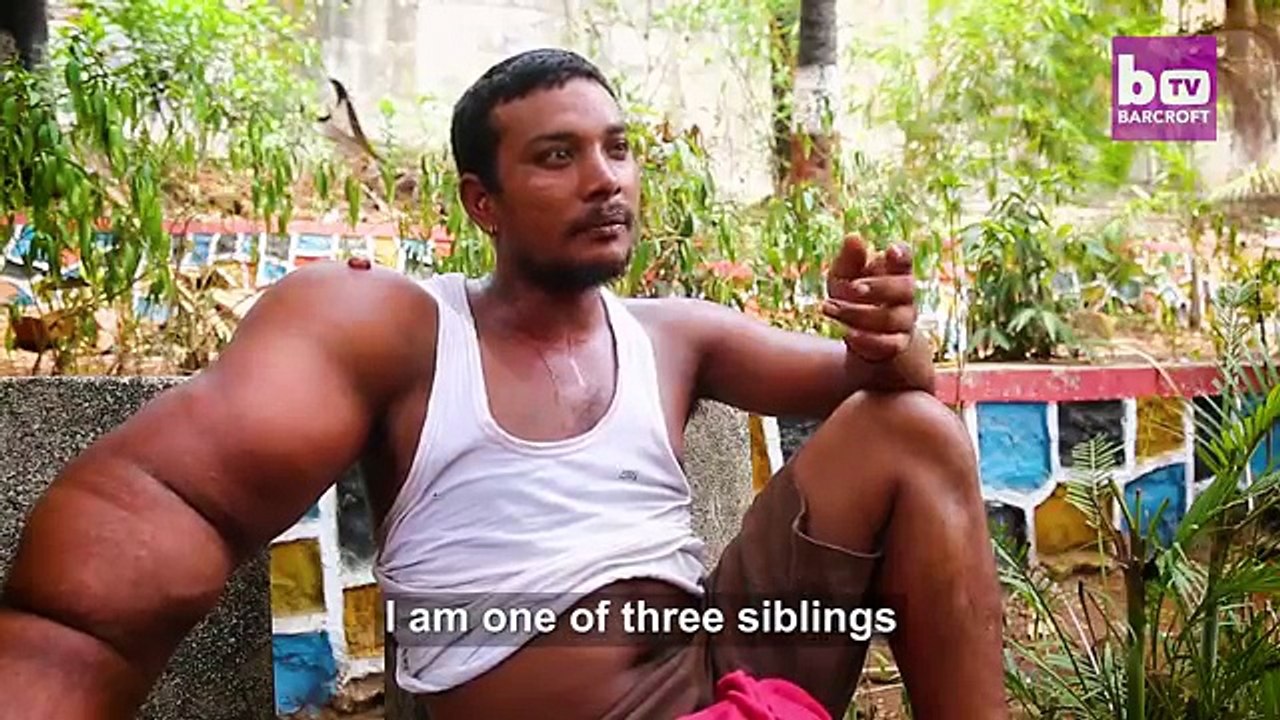 The Man With The 44lb Arm
