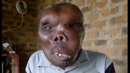 Uganda's 'Most Unusual Looking Man'-