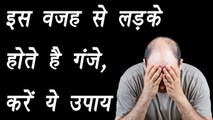 Baldness in Men treatment | Home Remedy | इस वजह से लड़के होते है गंजे, करें ये उपाय । BoldSky