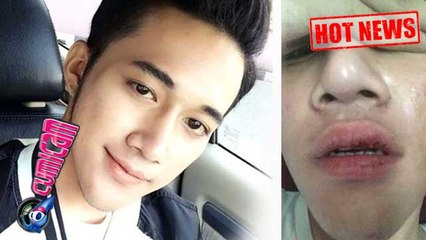 Hot News! Korban Keroyokan Dicky Smash Dipanggil Polisi - Cumicam 09 Agustus 2017