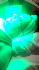 LED Light Therapy Melton | Laser Skin Treatments Melton | HS Place Hair Skin Beauty