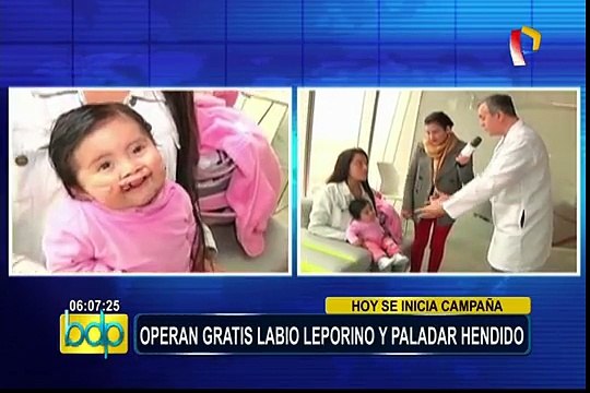 Misión Caritas Felices: operaciones gratuitas a niños con labio leporino y paladar hendido