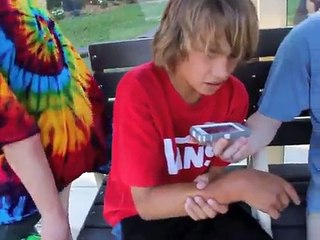 skateboarder breaks   his nuts