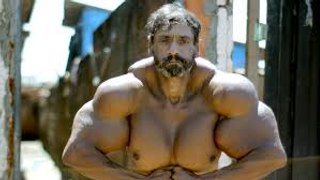 Bodybuilder’s Supersized Fake Muscles Could Kill Him