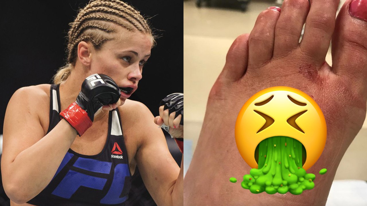 OUCH! UFC Fighter Paige VanZant Shows Off Disgusting Foot Injury - video  Dailymotion