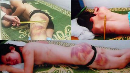 Chuyện có thật 7 ngày trong địa ngục của người vợ xinh đẹp bị chồng tra tấn