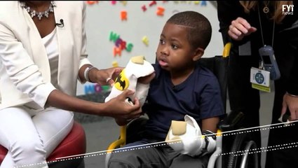 Hand Transplant Changes Zion's Life