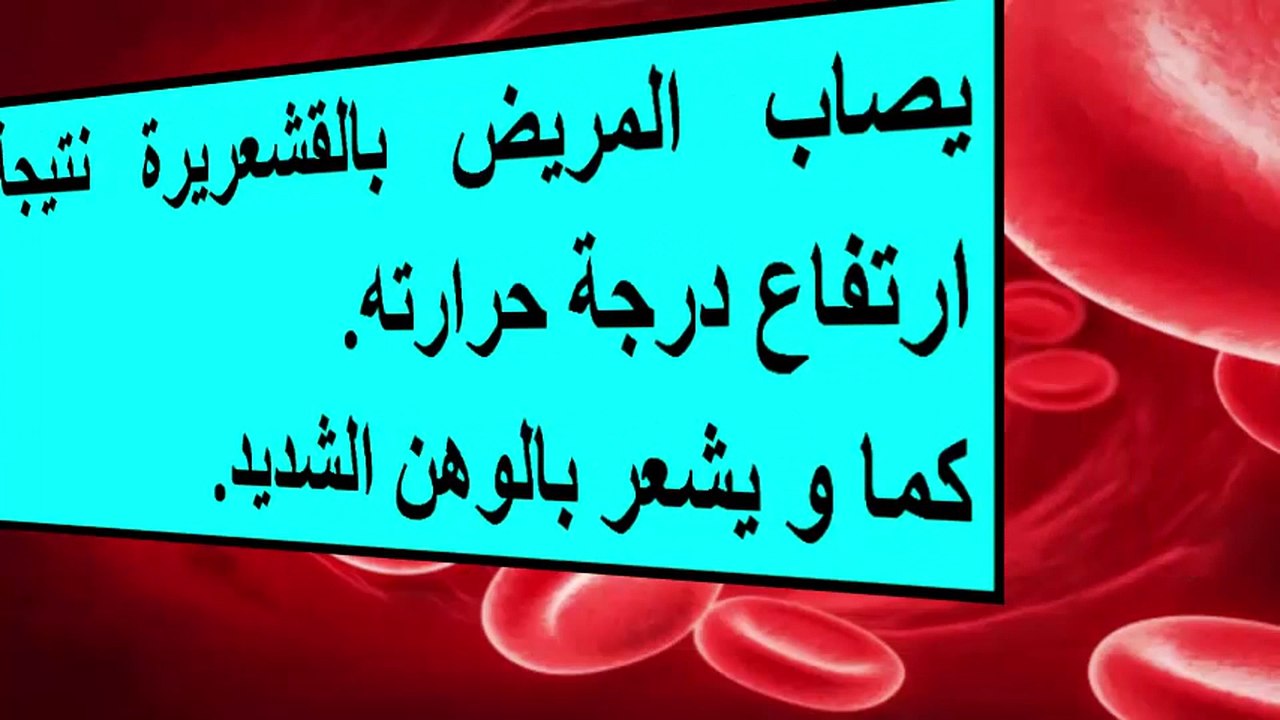 أعراض تسمم الدم