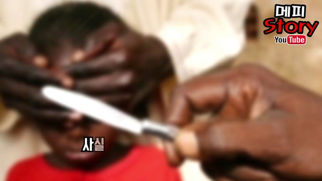 잔인한 수술 흑인 남성이 백인 성기를 가지게 된 이유 '할례' _ 메피스토리 #핫이슈 #화제 #논란 #정리