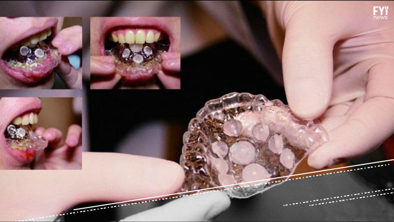 A Retainer for Maximum Pleasure