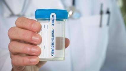 5 Tricks to Pass a Drug Test