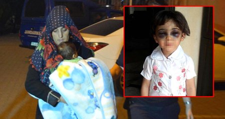 Vicdansız Üvey Anne, 3 Yaşındaki Kızı Darp Ederek Tanınmaz Hale Getirdi!