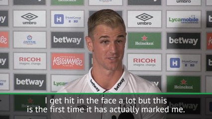 Andy Carroll gave me the black eye...jokes Hart