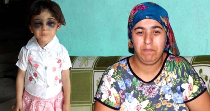 Üven Anne Şiddetine Maruz Kalan Kız Çocuğunun Öz Annesi Şikayetçi Oldu