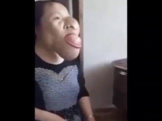 Elle a la tête 2 fois trop grosse à cause d'un cancer