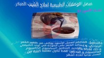 افضل الوصفات الطبيعية للشيب المبكر