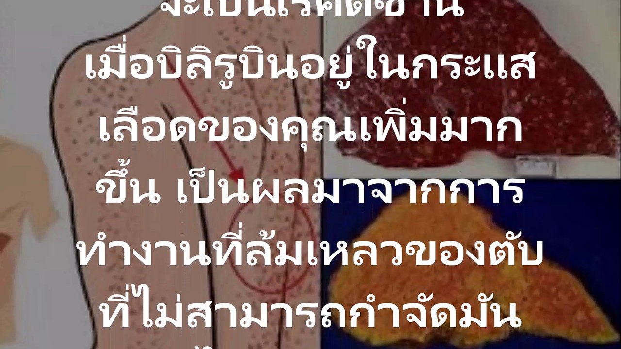 Observe yourself before it's too late 12 signs that your liver is near collapse, then!