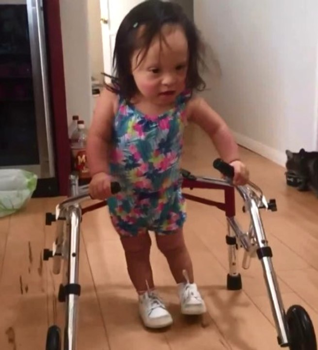 Down Sendromlu Bebeğin İlk Adımları