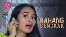 Rahangnya Alami Pembengkakan, Faby Marcelia Tetap Syuting - Cumicam 14 Agustus 2017