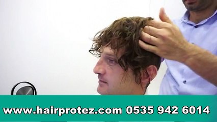 Protez Saç Kesimi Ve Uygulamsı-hairprotez 0535 942 6014