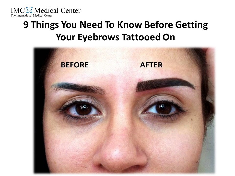 9 Things You Need To Know Before Getting