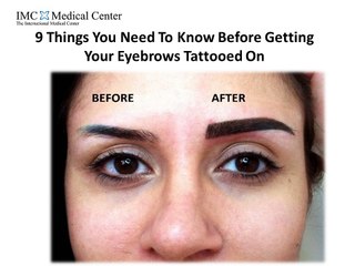 9 Things You Need To Know Before Getting