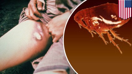 The Black Death returns to the United States