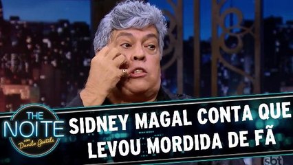 Sidney Magal conta que levou mordida de fã