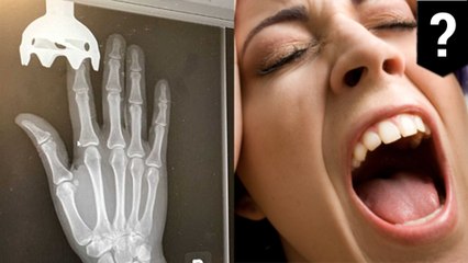 Woman gets her finger sliced by and stuck in immersion blender