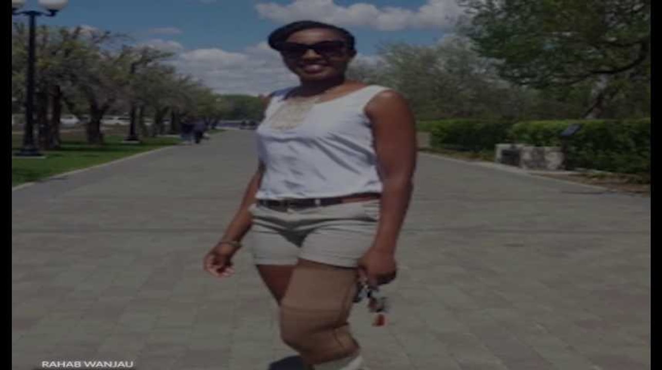 Amputée d'une jambe, elle ne trouve pas de prothèse de sa couleur de peau