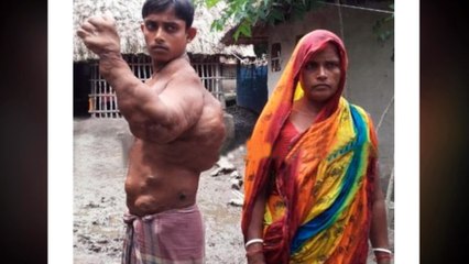 মুক্তামনির পরে মারাত্বক রোগে আক্রান্তু সাতক্ষীরার রাজীব !! দেখুন আল্লাহ্ আপনাকে কত শান্তিতে রেখেছেন!