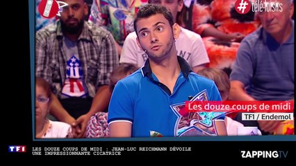 Jean-Luc Reichmann blessé dans un accident, il dévoile son impressionnante cicatrice (Vidéo)