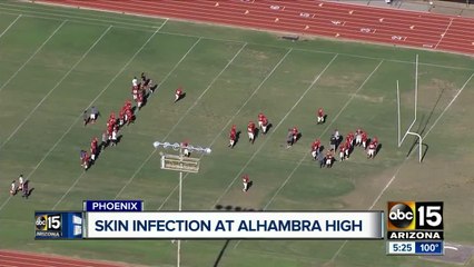 High school football game canceled due to skin infection