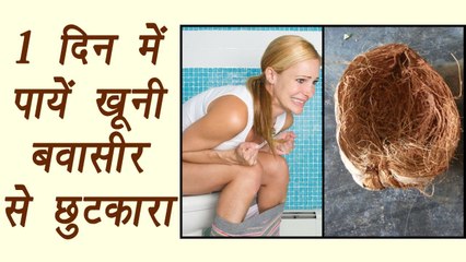 Piles or Hemorrhoids, Home remedy | 1 दिन में पायें खूनी बवासीर से छुटकारा | Boldsky