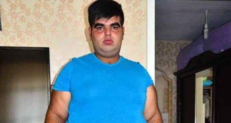 Kiloları Hayatını Kararttı! Her 3 Ayda 12 Kilo Alıyor