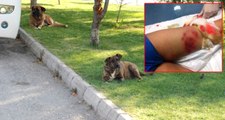 Eskişehir'de 5 Köpeğin Saldırısına Uğrayan Çocuk, Ölümden Döndü